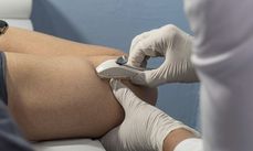 Aplicações do Implanon