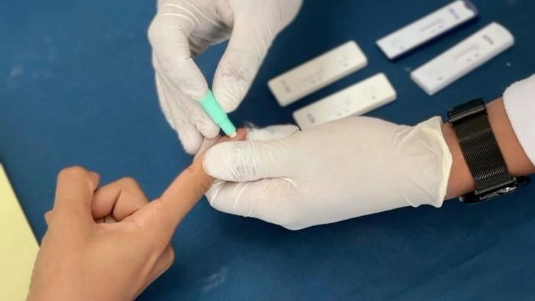 SEMUS conscientiza população a realizar teste rápido contra ISTs