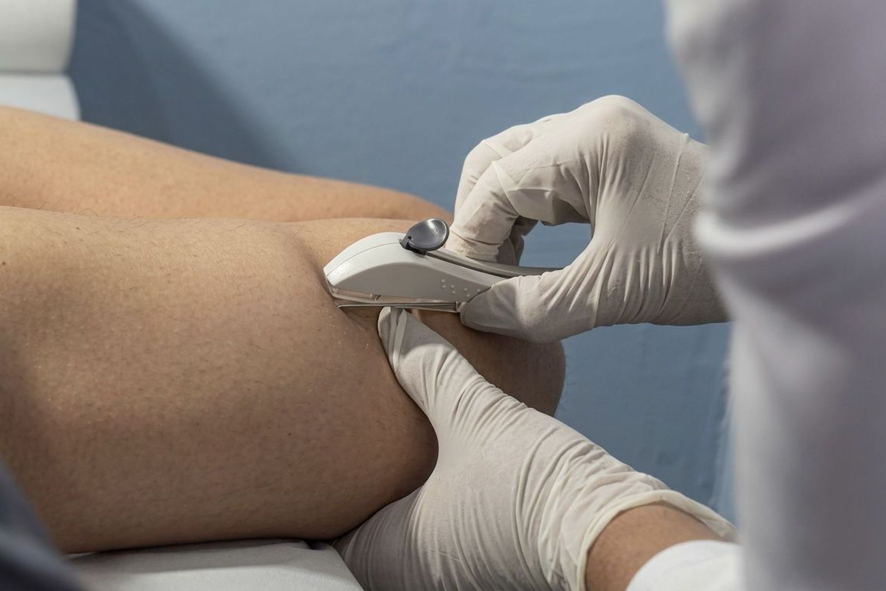 Mulheres começam a receber Implanon na rede pública de saúde de Imperatriz