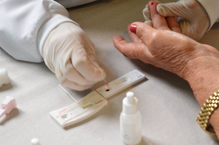 Semus aumenta oferta de exames para diagnóstico de hepatites virais