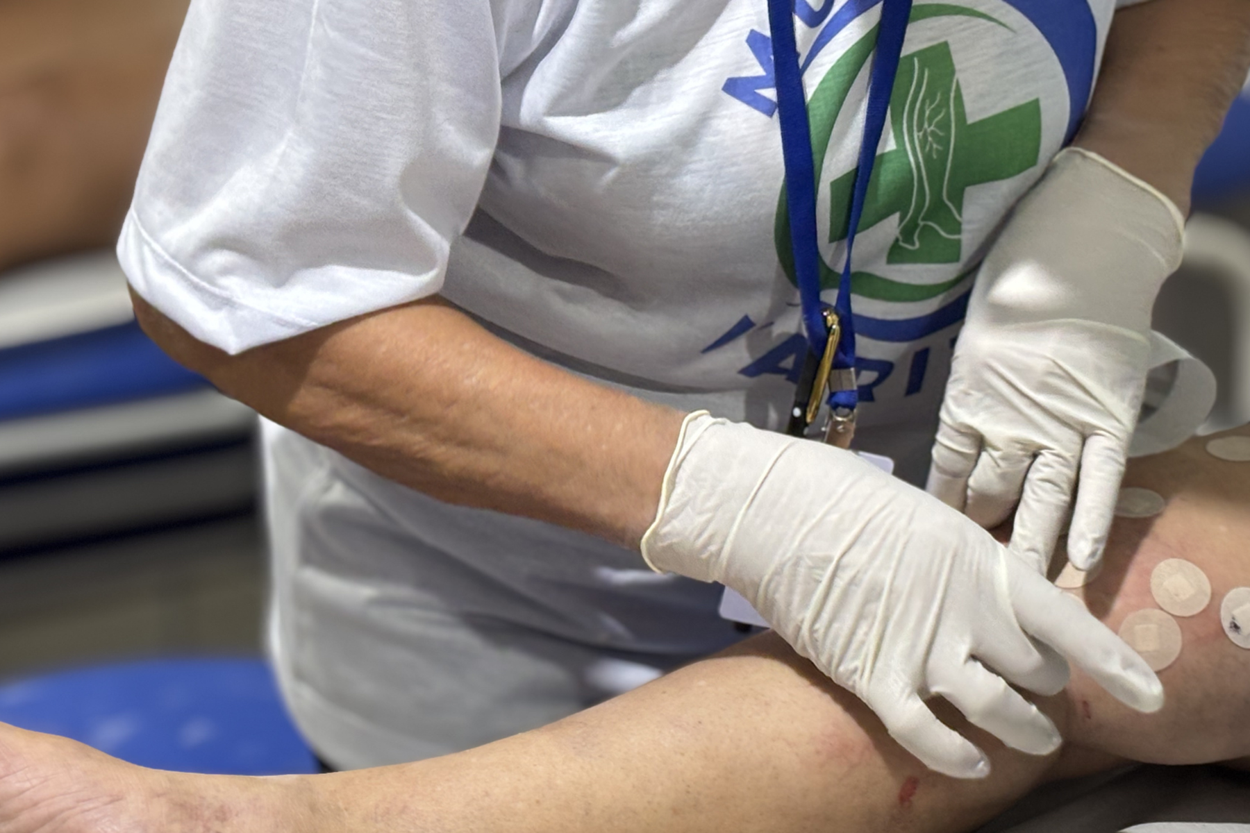 Prefeitura de Imperatriz realiza 4º mutirão de cirurgia de varizes