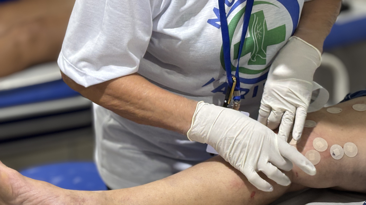 Prefeitura de Imperatriz realiza 4º mutirão de cirurgia de varizes