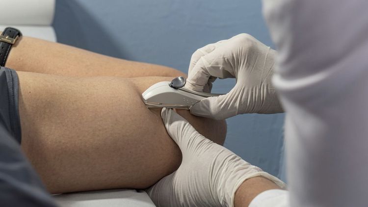 Mulheres começam a receber Implanon na rede pública de saúde de Imperatriz