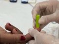 Em 2025, foram registrados 5 casos de hepatite B e 11 casos de hepatite C do município