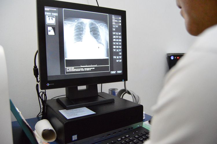 Radiografia digital, mais uma novidade na Saúde Municipal